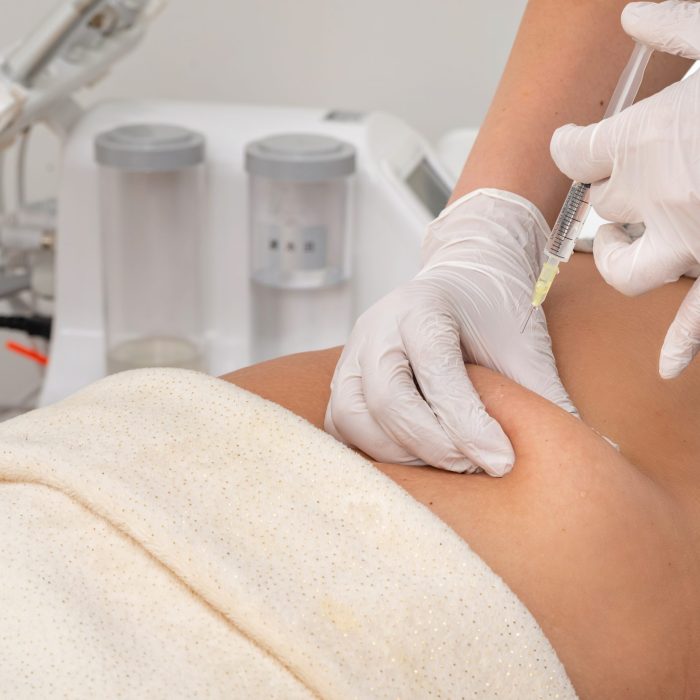 mesoterapia-area-abdominal-es-metodo-inyeccion-cosmetologia-estetica-moldear-cuerpo